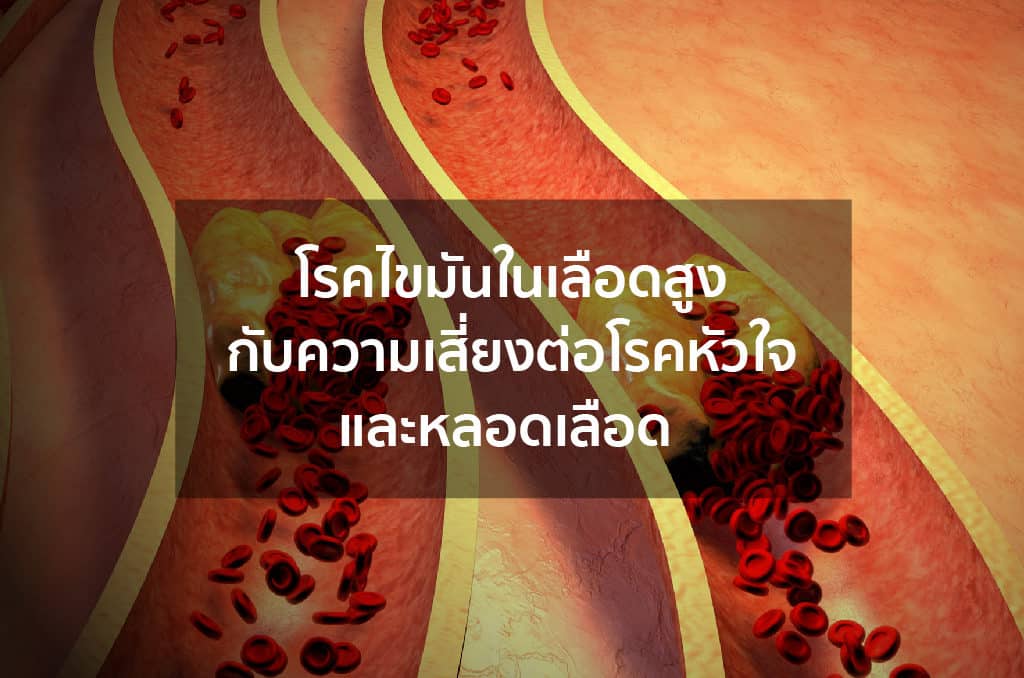 Dyslipidemia