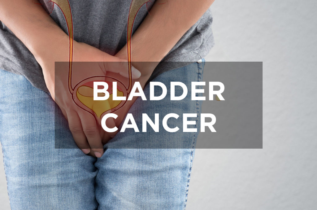 Bladder Cancer