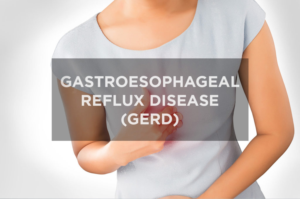 Gastroesophageal Reflux Disease (GERD)