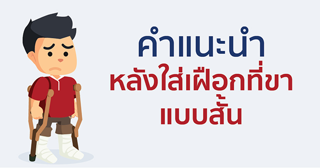 คำแนะนำหลังใส่เฝือกที่ขาแบบสั้น