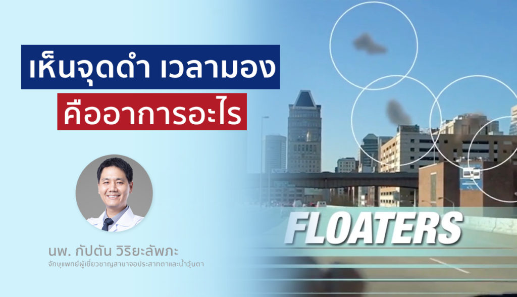 เห็นจุดดำ เวลามอง คืออาการอะไร?